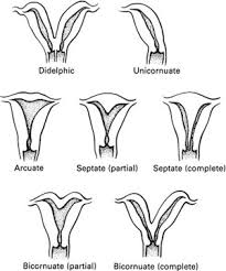 uterine anom